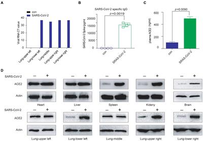 Folic <mark class="highlighted">acid</mark> restricts SARS-CoV-2 invasion by methylating ACE2